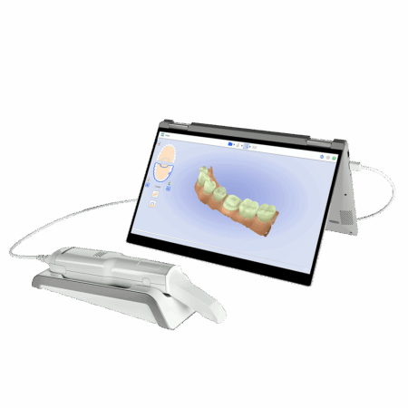 Skaner wewnątrzustny z wizualizacją 3D uzębienia na ekranie – nowoczesna diagnostyka ortodontyczna wykorzystywana w planowaniu leczenia nakładkami Invisalign®.