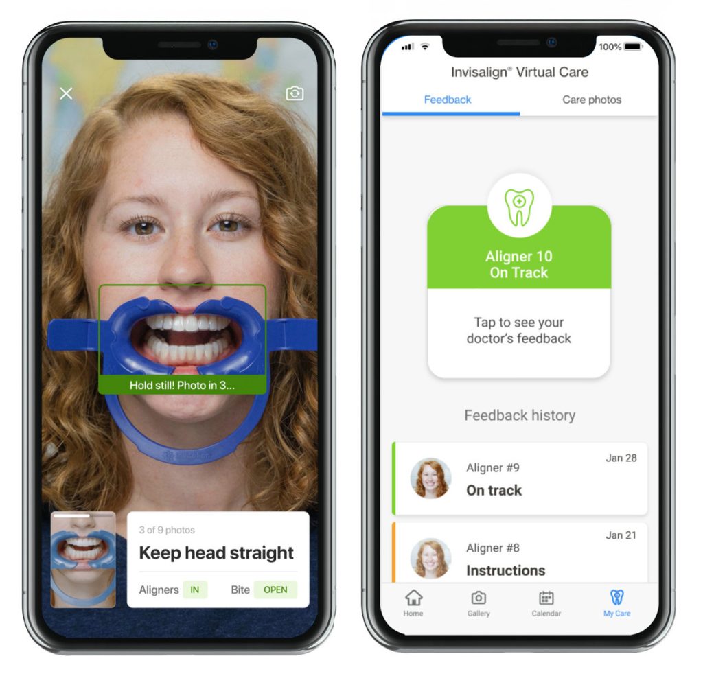 Aplikacja My Invisalign i widok Virtual Care, czyli funkcji, która umożliwia zdalne monitorowanie leczenia ortodontycznego.